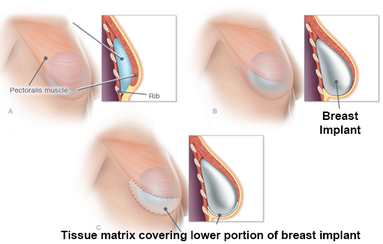 Breast Surgery treatment Centre In Navi Mumbai