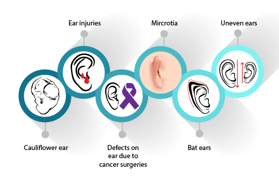 ear surgery in navi mumbai