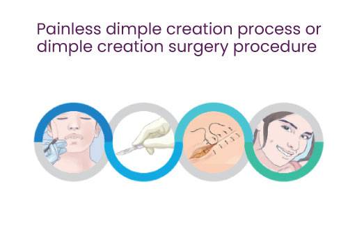 dimple creation process