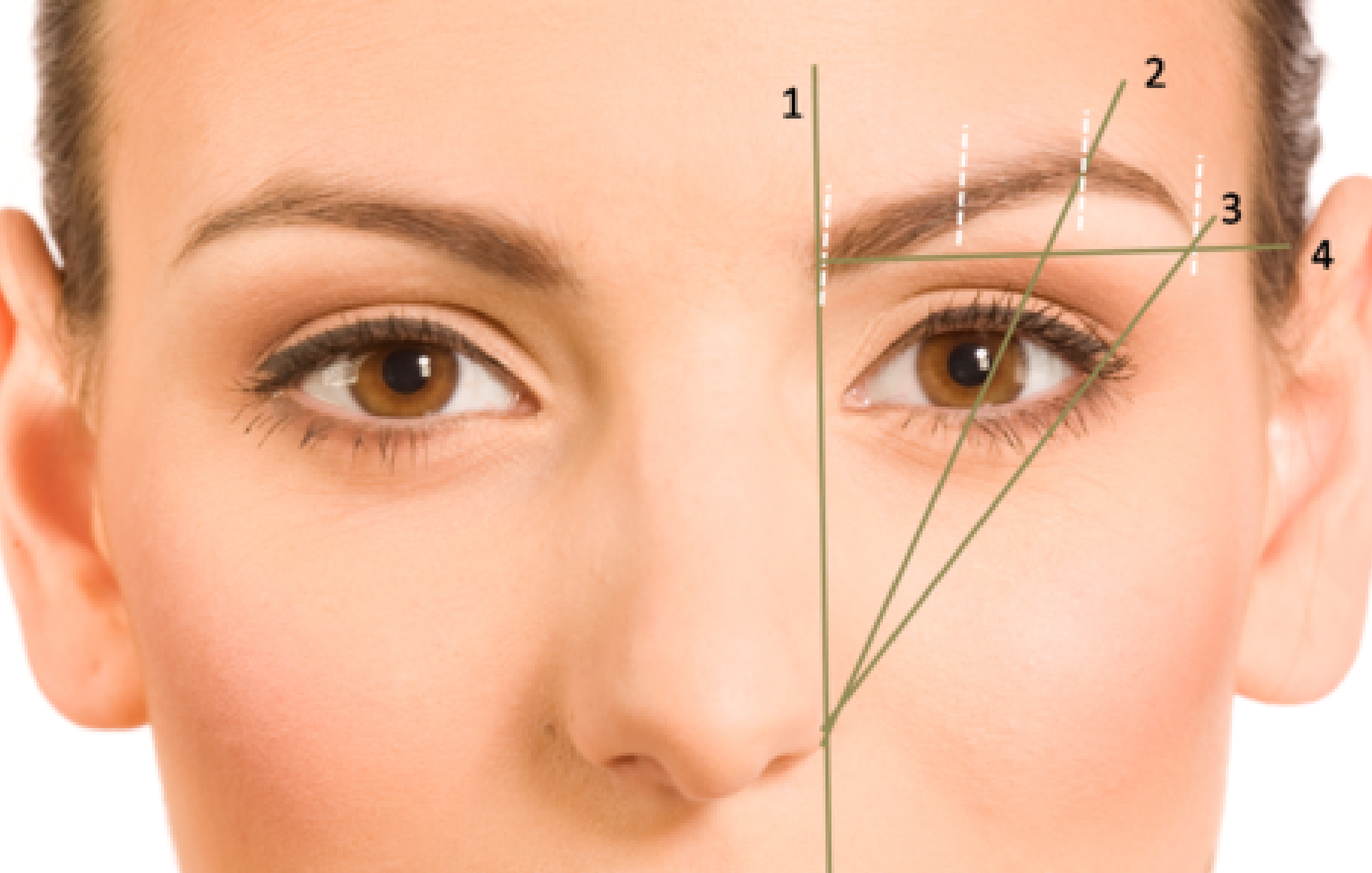 eyebrow transplantation procedure