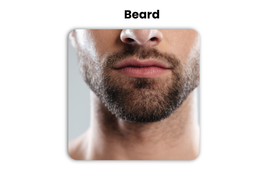 beard and body hair transplant