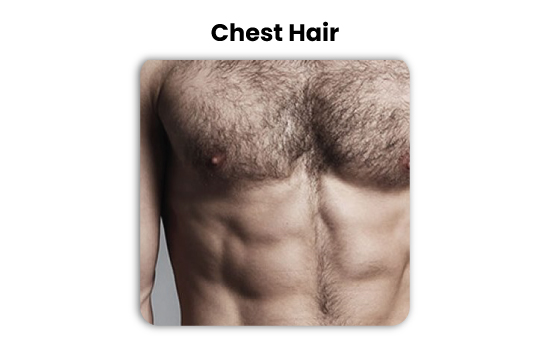 chest and body hair transplant