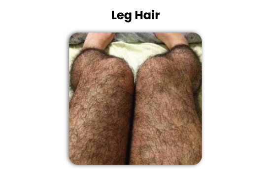 leg and body hair transplant