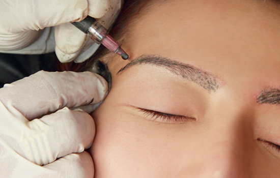 eyebrow transplantation procedure