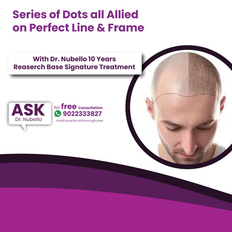scalp micro pigmentation treatment