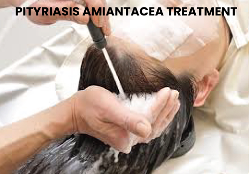 pityriasis amiantacea treatment in Mumbai